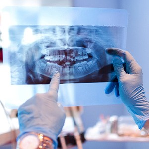 A dentist holding an X-ray